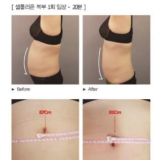 [부산] 에스테틱힐링수
