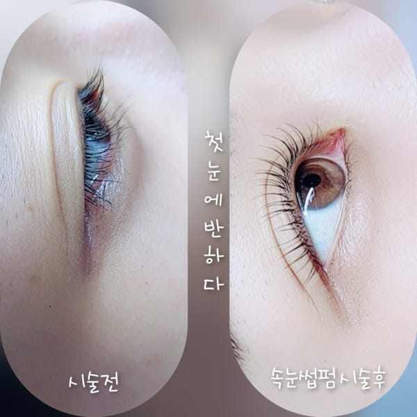 [경기 여주] 첫눈에 반하다