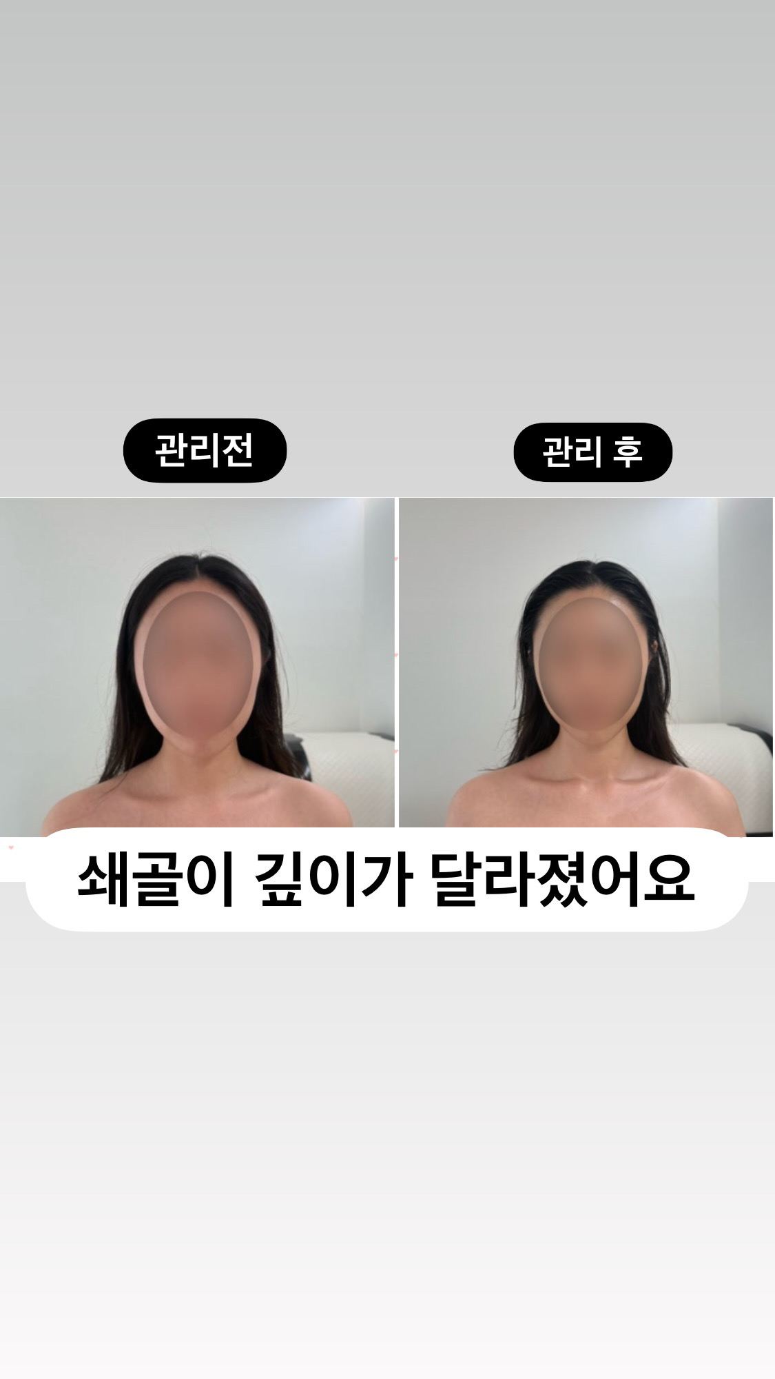 경기 하남시 뷰티 추천 | 오올에스테틱 체험단 모집으로 아름다움을 경험하세요!